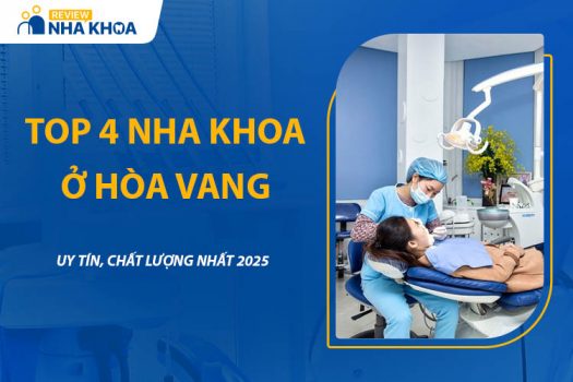 Top 4 Nha Khoa Ở Hòa Vang Uy Tín, Chất Lượng Nhất 2025