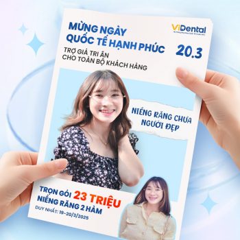 Niềng răng trọn gói chỉ 23 triệu/2 hàm