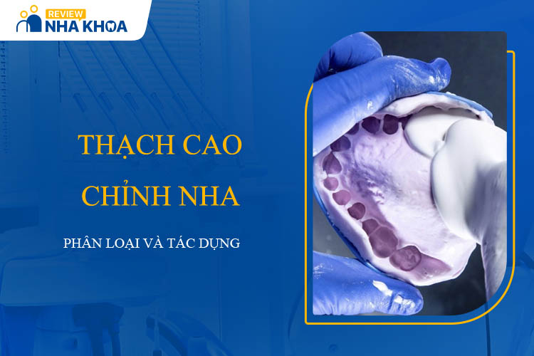Thạch Cao Chỉnh Nha: Giới Thiệu và Lợi Ích