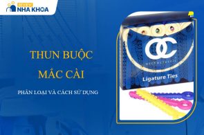 Thun Buộc Mắc Cài: Tất Tần Tật Những Điều Cần Biết