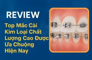 Niềng răng mắc cài kim loại