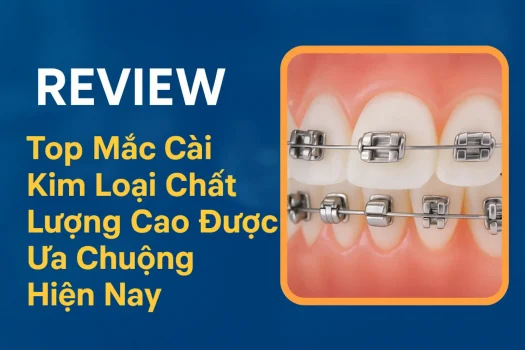Niềng răng mắc cài kim loại